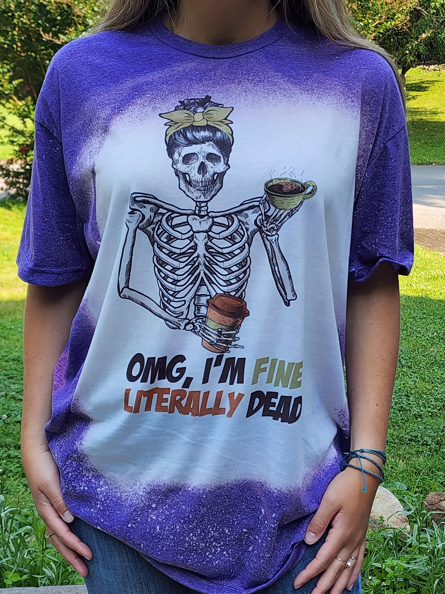 OMG I'm Fine, Literally Dead - Skeleton Messy Bun-Sublimation Shirt