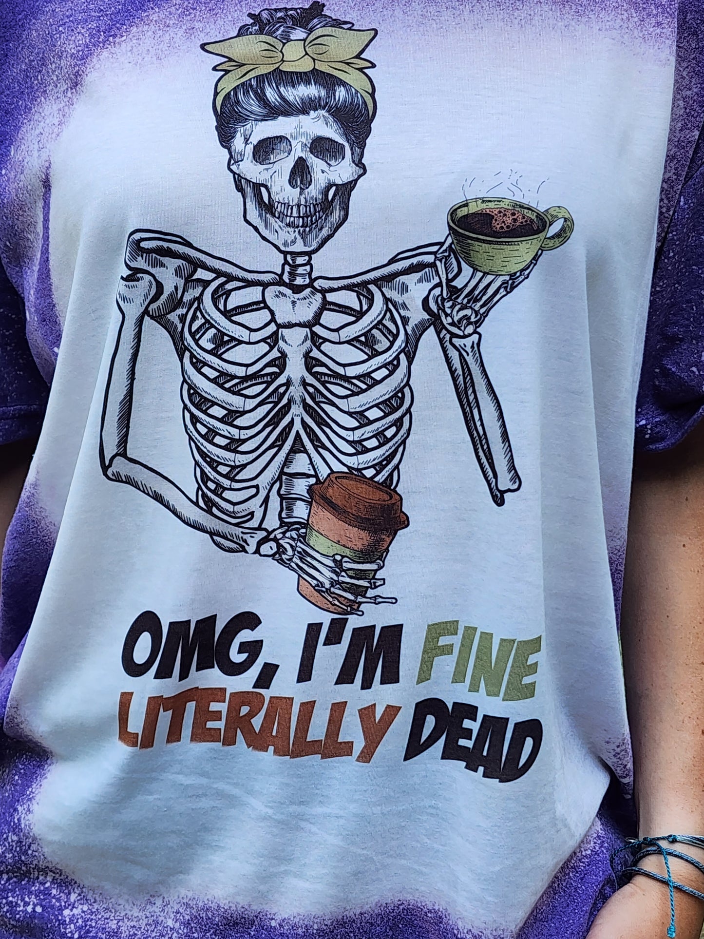 OMG I'm Fine, Literally Dead - Skeleton Messy Bun-Sublimation Shirt